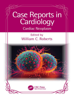 cover image of Cardiac Neoplasm